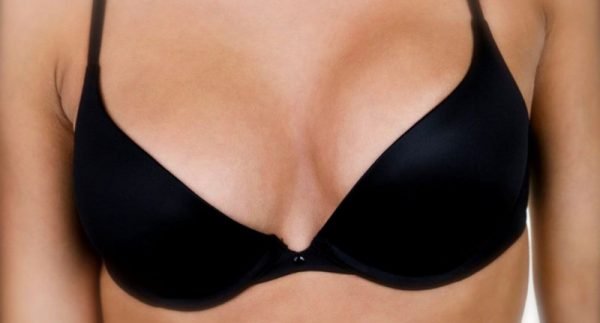 Breast Augmentation
